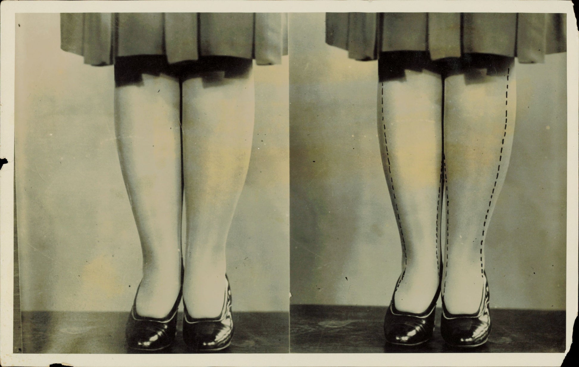 Leg Photographs (1922 - 1958) (15 vintage prints) Fashion